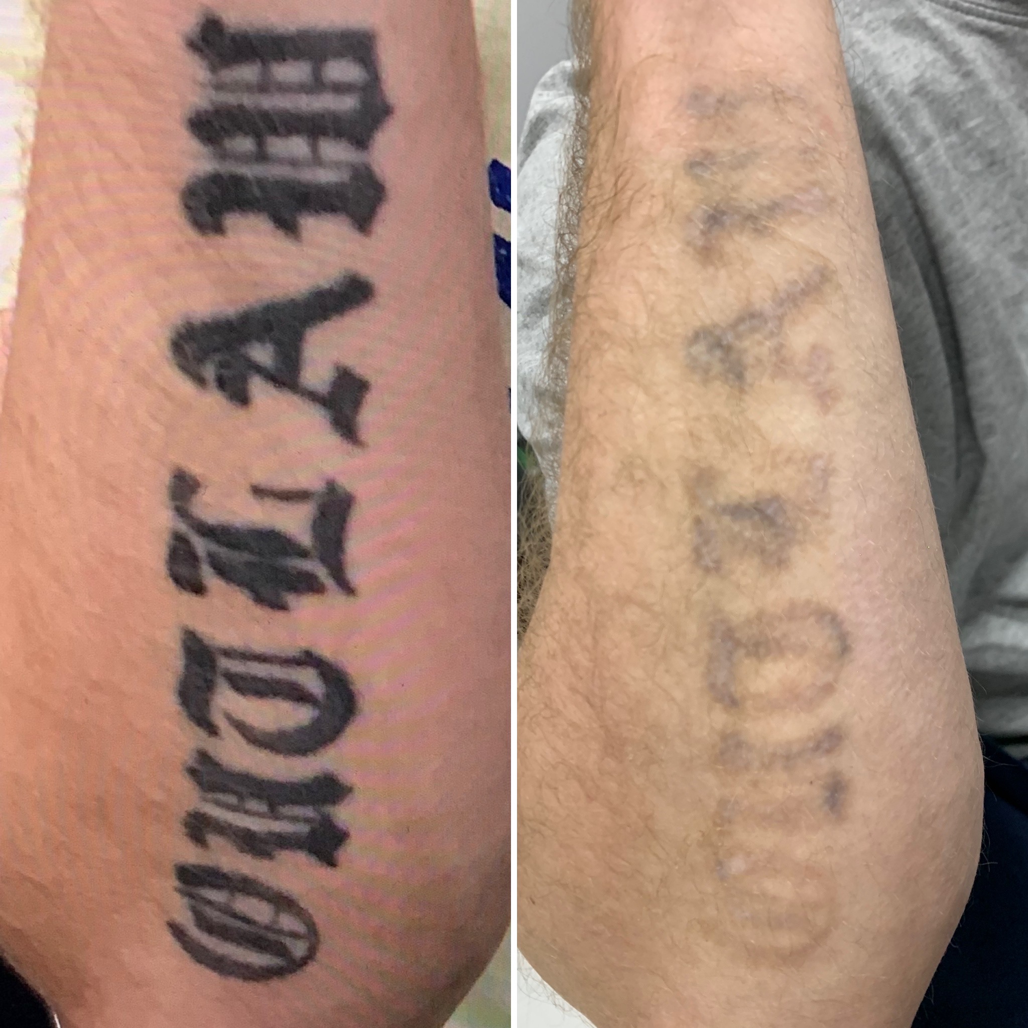 tatoeage-zwart-arm